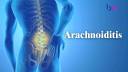 Arachnoiditis