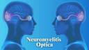 Neuromyelitis Optica