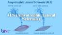 ALS (Amyotrophic Lateral Sclerosis)